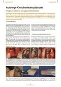 Implantologie Journal 4 2009